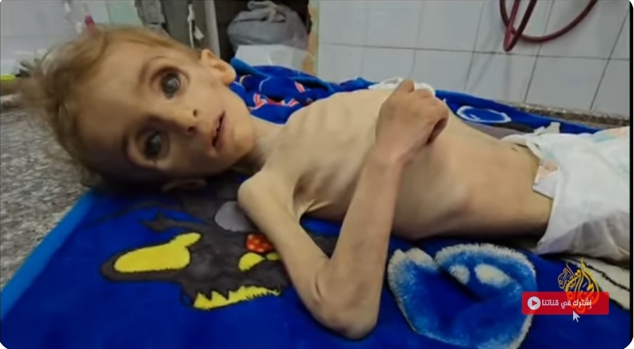 المجاعة تفتك في غزة على مسمع ومرئى المسلمين الذين صلوا اليوم الجمعة؟ ياسر الحريري
